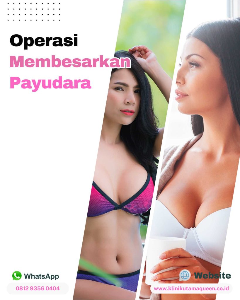 Implan vs Pembesaran Payudara: Apa Bedanya? Cari Tahu di Sini!