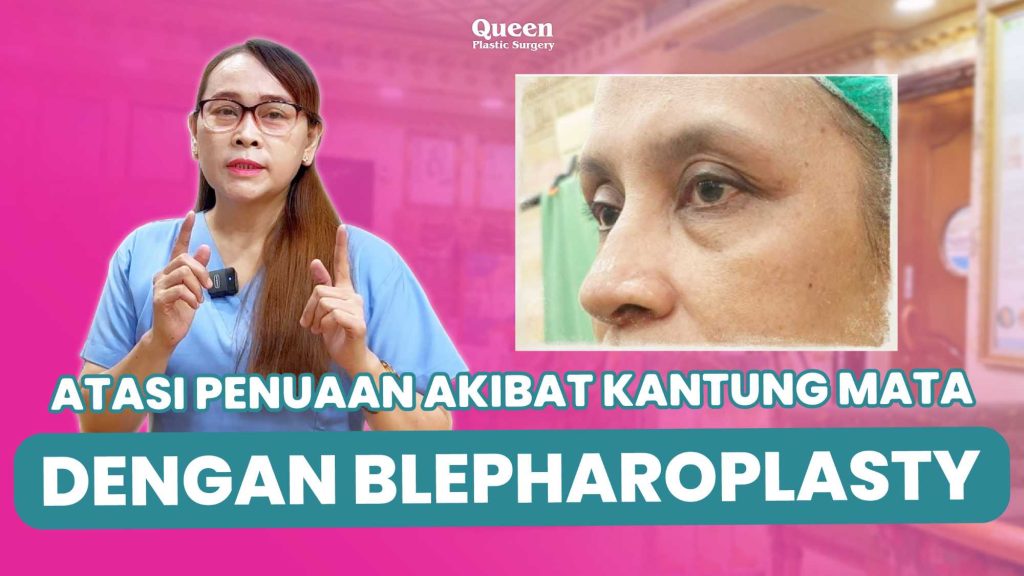 Operasi Kelopak Mata Bawah Cara Ampuh Atasi Kerutan Membandel