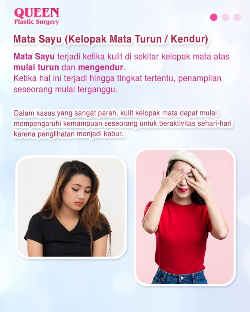 Mata Tampak Lebih Segar: Kenali Manfaat Pengencangan Alis untuk Mengatasi Mata Sayu