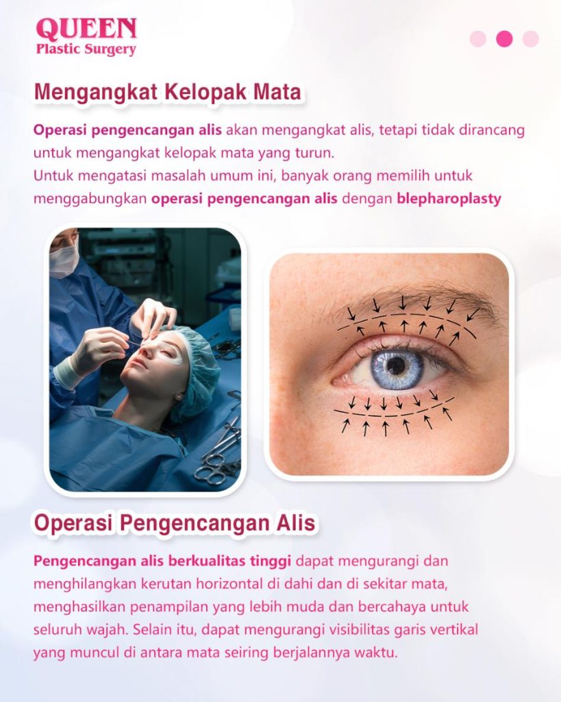 Mata Tampak Lebih Segar: Kenali Manfaat Pengencangan Alis untuk Mengatasi Mata Sayu