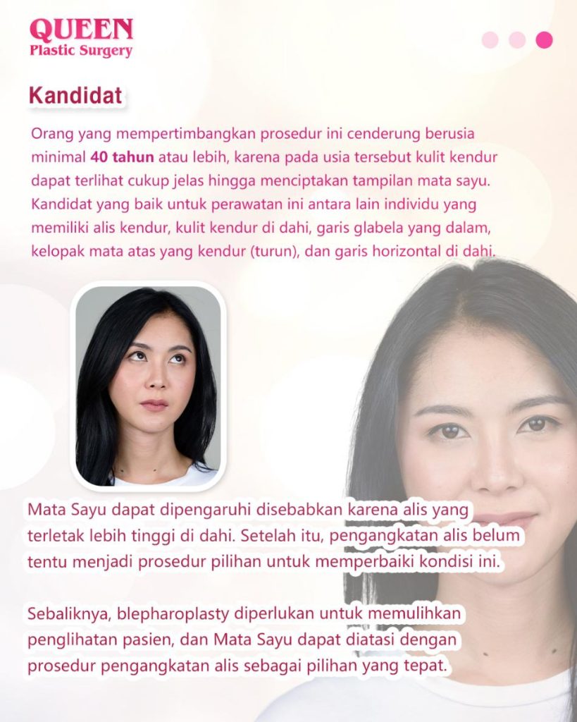 Mata Tampak Lebih Segar: Kenali Manfaat Pengencangan Alis untuk Mengatasi Mata Sayu
