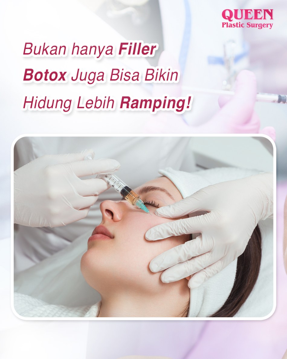 Bukan Hanya Filler, Botox Juga Bisa Bikin Hidung Lebih Ramping!