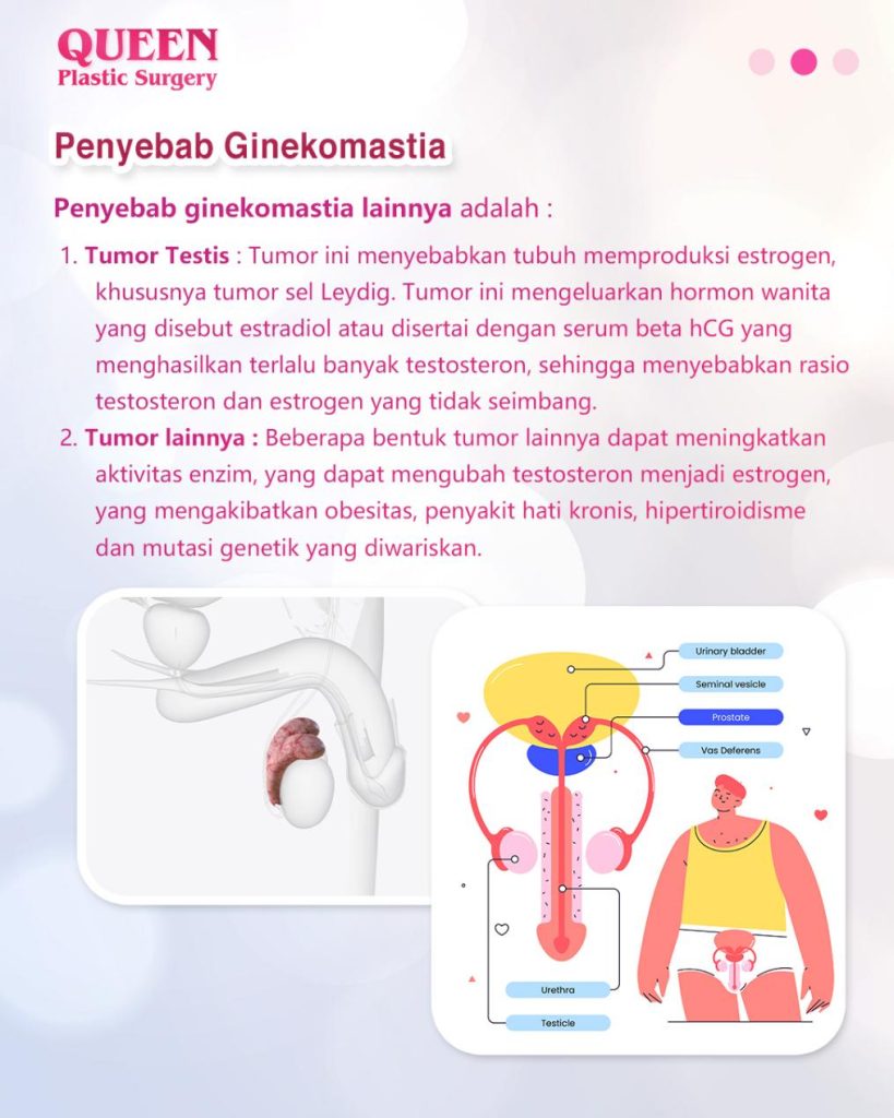 Ginekomastia Setelah Penurunan Berat Badan: Mengapa Terjadi dan Bagaimana Mengatasinya?