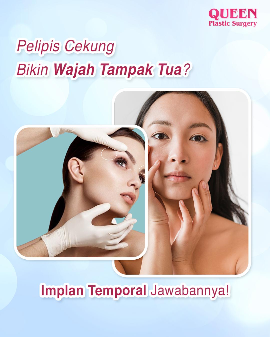 Pelipis Cekung Bikin Wajah Tampak Tua? Implan Temporal Jawabannya!