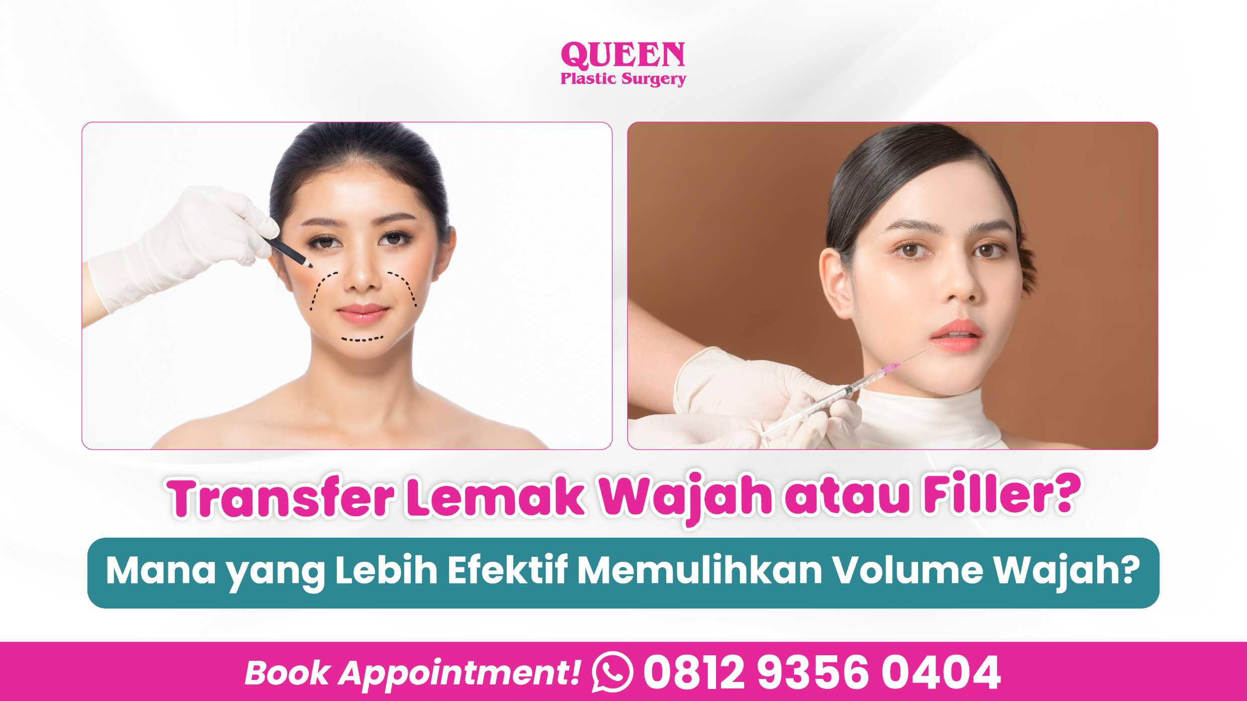 Transfer Lemak Wajah vs. Dermal Filler: Pilih Mana untuk Wajah Kencang dan Bervolume Alami?