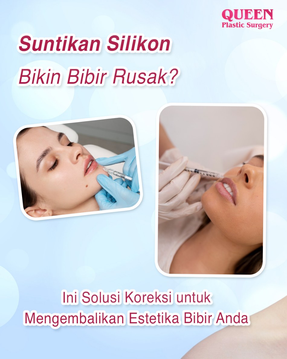 Suntikan Silikon Bikin Bibir Rusak? Ini Solusi Koreksi untuk Mengembalikan Estetika Bibir Anda
