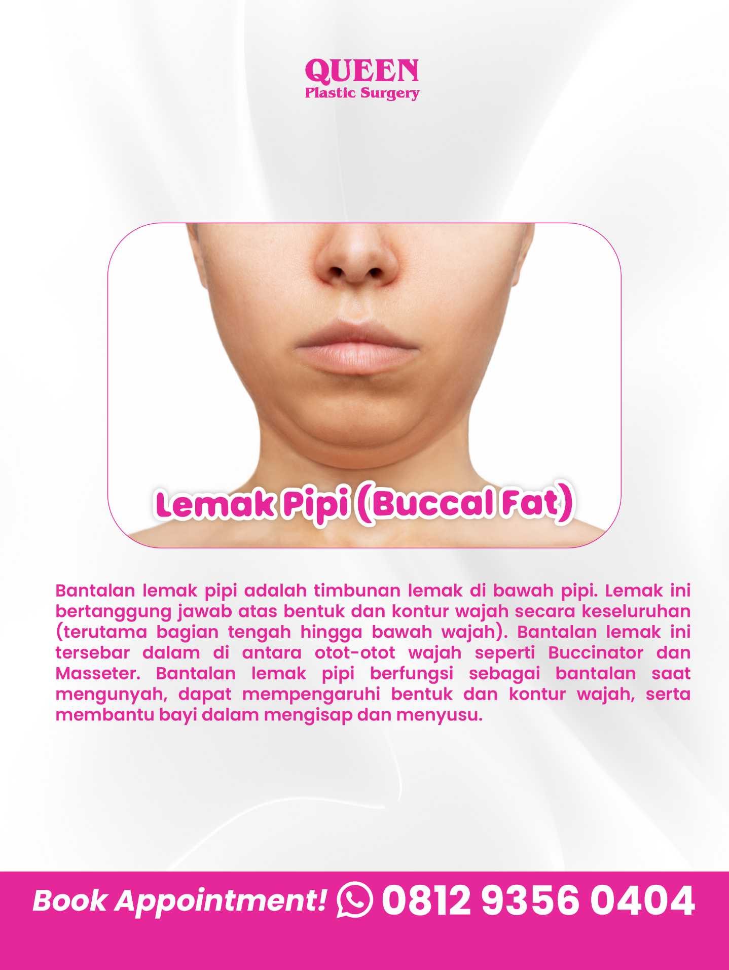 Bye-Bye Pipi Chubby! Merampingkan Wajah Bulat dengan Operasi Pengangkatan Lemak Pipi