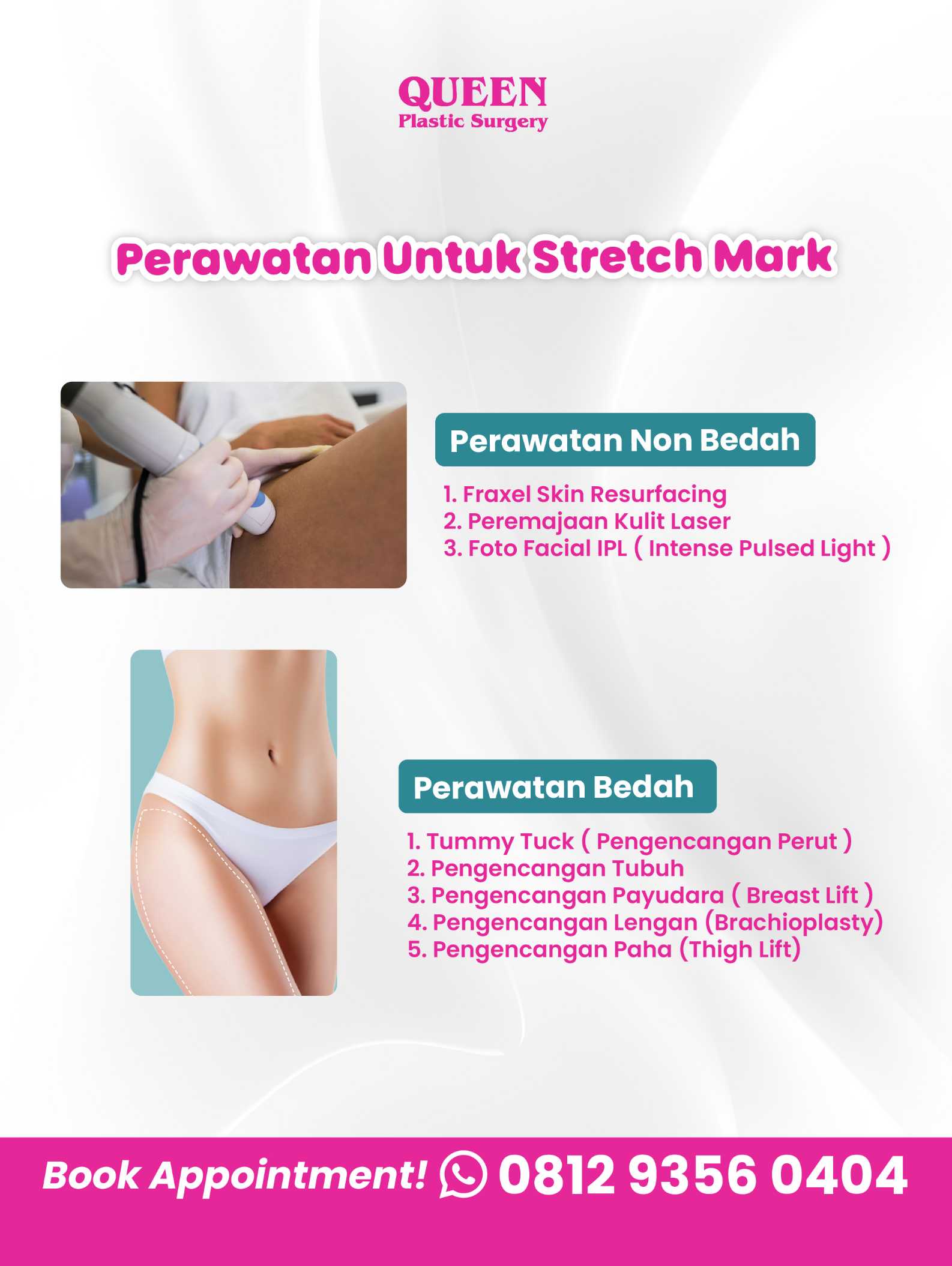 Stretch Mark Mengganggu? Kenali Prosedur Operasi Plastik yang Bisa Jadi Solusinya