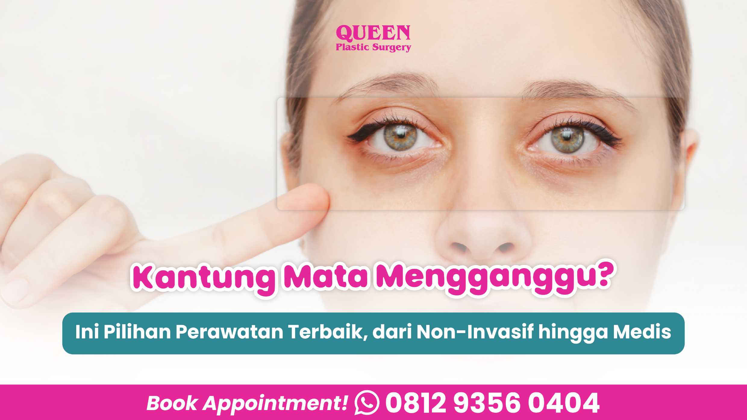 Kantung Mata Mengganggu? Ini Pilihan Perawatan Terbaik, dari Non-Invasif hingga Medis