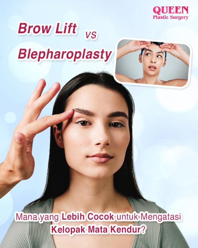 Brow Lift vs Blepharoplasty: Mana yang Lebih Cocok untuk Mengatasi Kelopak Mata Kendur?