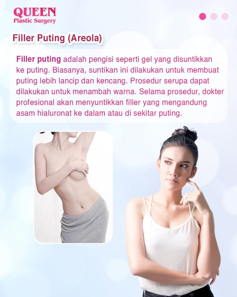 Dermal Filler untuk Puting: Alternatif Cepat untuk Koreksi Proyeksi dan Bentuk
