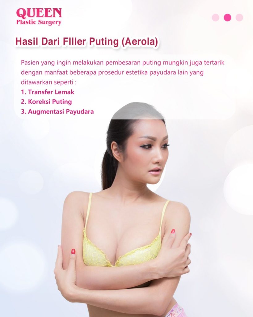 Dermal Filler untuk Puting: Alternatif Cepat untuk Koreksi Proyeksi dan Bentuk
