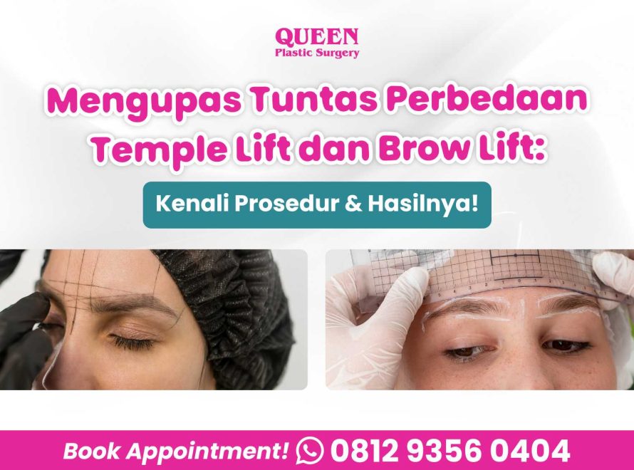 Mengupas Tuntas Perbedaan Temple Lift dan Brow Lift: Kenali Prosedur & Hasilnya!