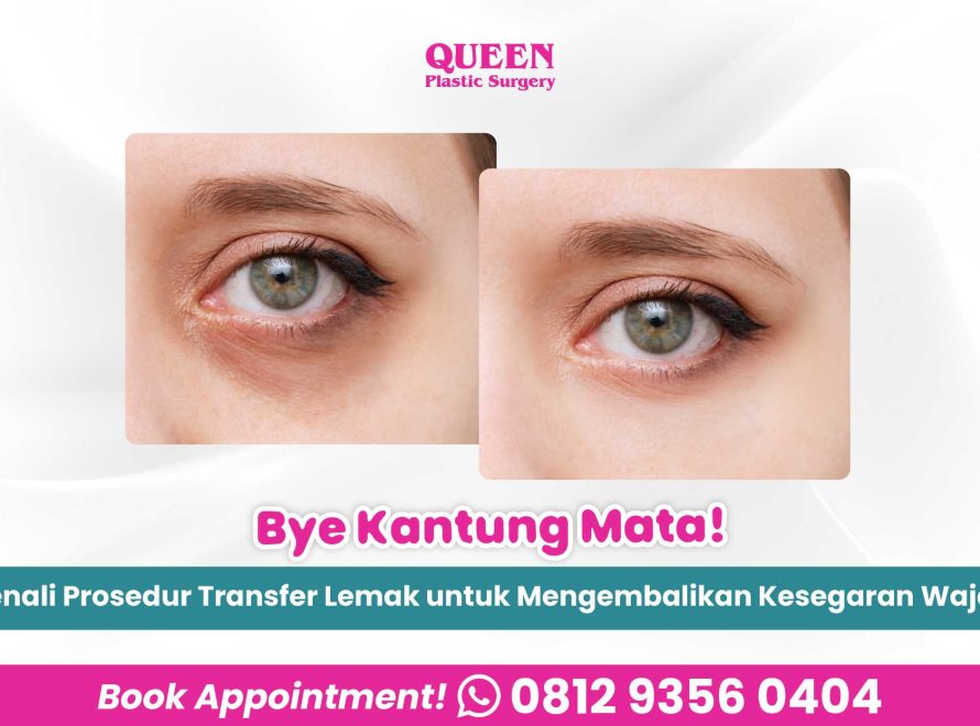 Bye Kantung Mata! Kenali Prosedur Transfer Lemak di Bawah Mata untuk Mengembalikan Kesegaran Wajah