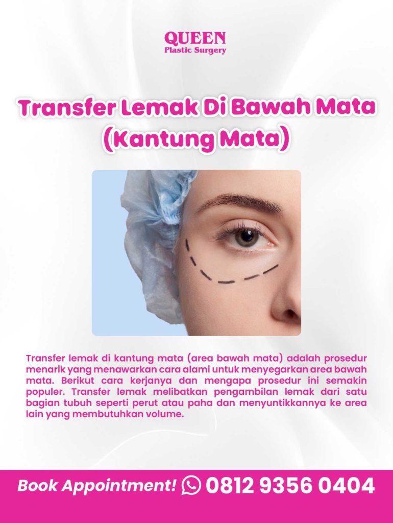 Bye Kantung Mata! Kenali Prosedur Transfer Lemak di Bawah Mata untuk Mengembalikan Kesegaran Wajah