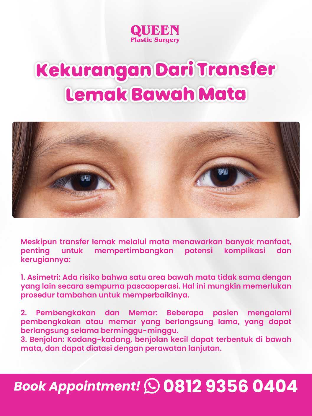 Bye Kantung Mata! Kenali Prosedur Transfer Lemak di Bawah Mata untuk Mengembalikan Kesegaran Wajah