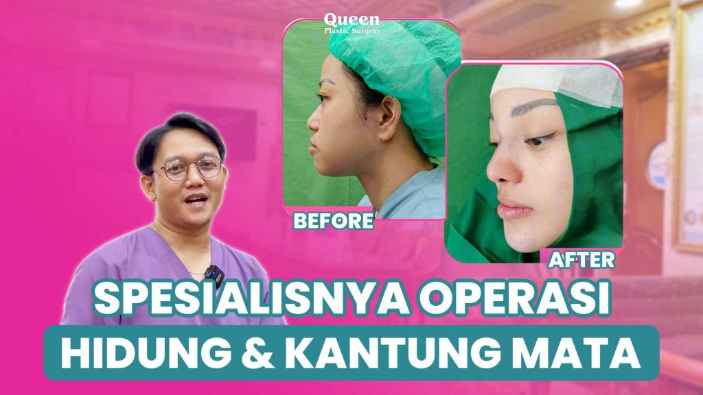 Rahasia Tampil Awet Muda, Hilangkan Kerutan Mata dan Mata Lelah Dengan Blepharoplasty!