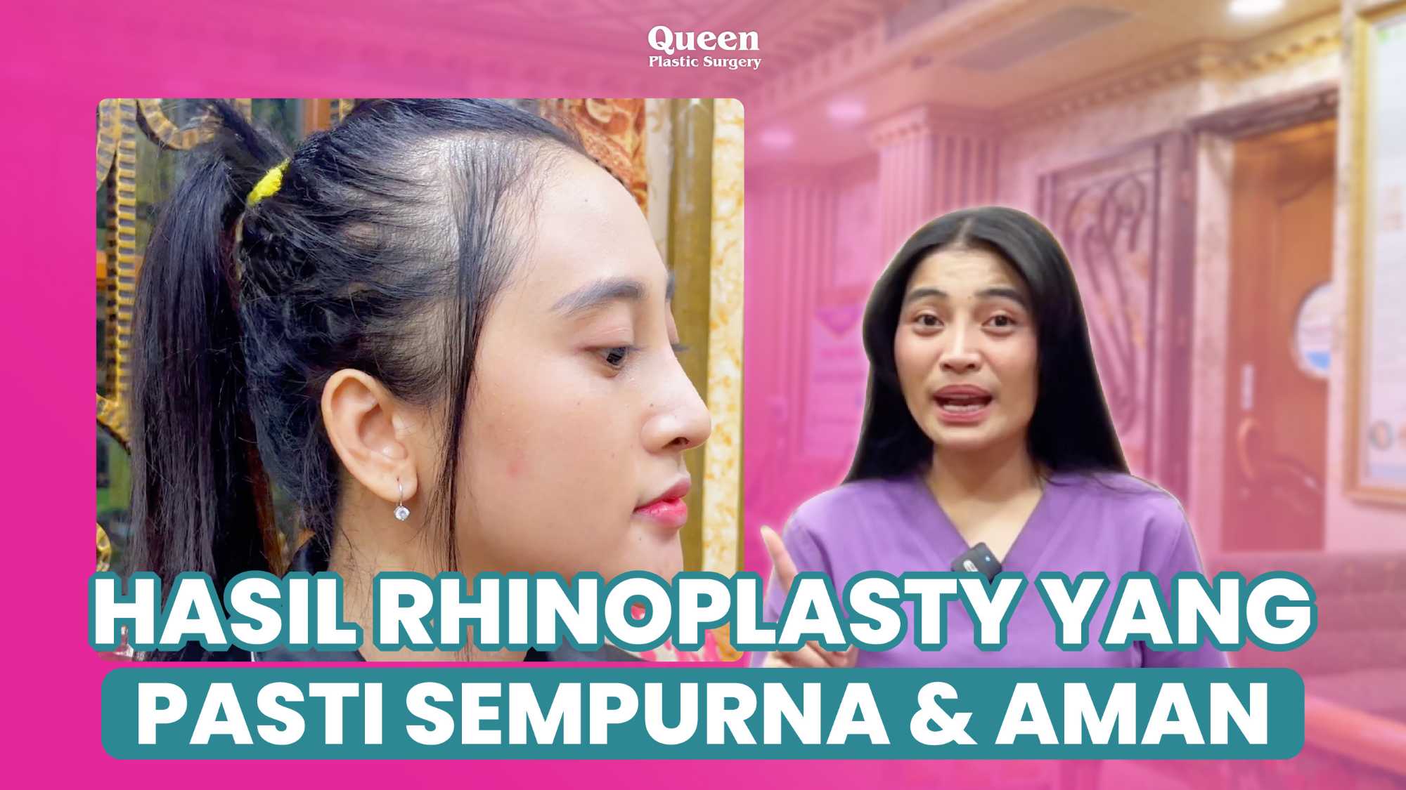 Gagal Operasi Hidung? Ini Tanda Operasi Hidung Yang Buruk