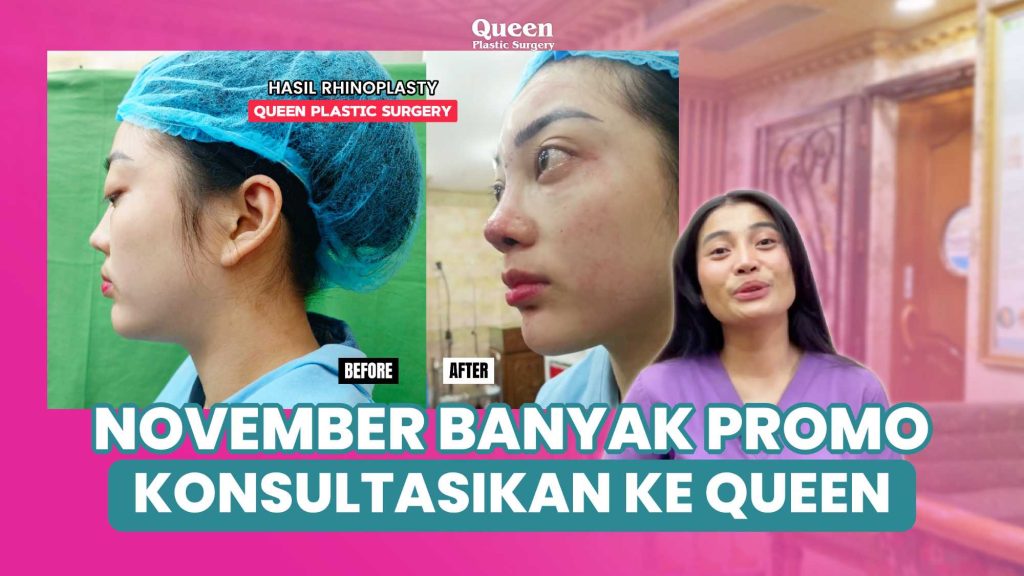 Mengenal Anestesi dalam Operasi Plastik : Risiko dan Cara Mempersiapkan Diri
