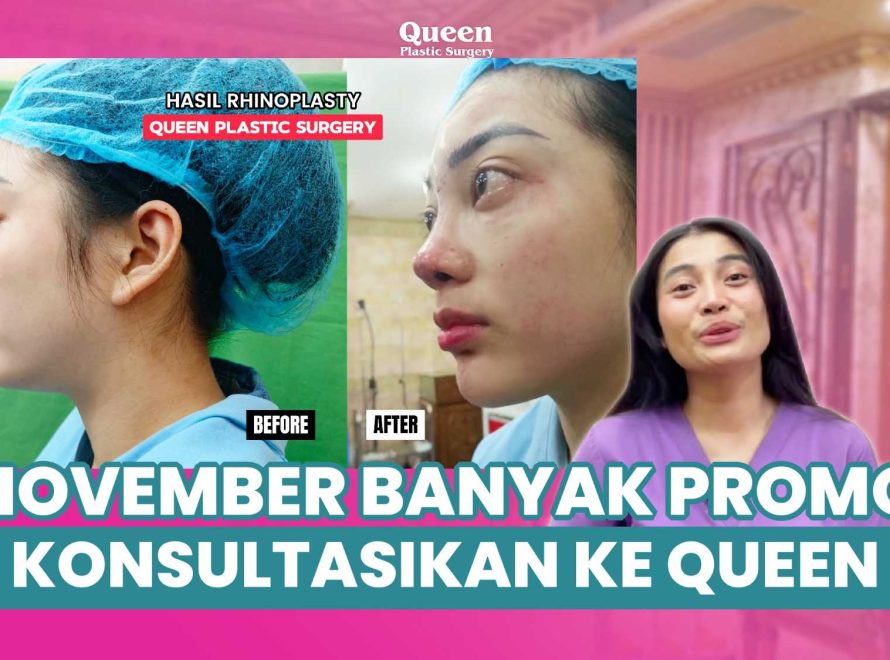 Mengenal Anestesi dalam Operasi Plastik : Risiko dan Cara Mempersiapkan Diri