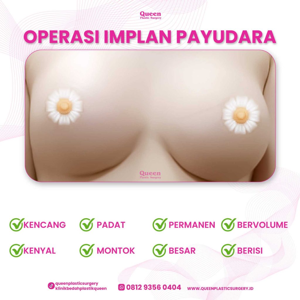 Tips Aman Mengemudi Pasca Operasi Implan Payudara