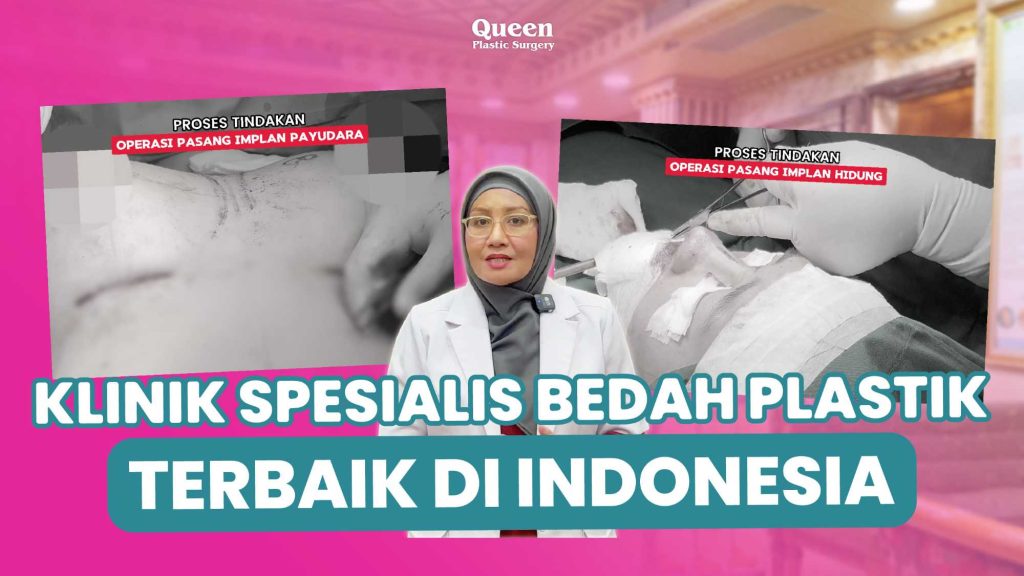 Bisakah Transfer Lemak Menggantikan Implan? Temukan Jawabannya!