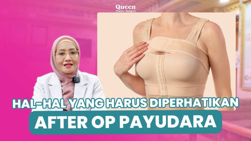 Aturan Mengemudi Pasca Bedah Payudara agar Pemulihan Maksimal