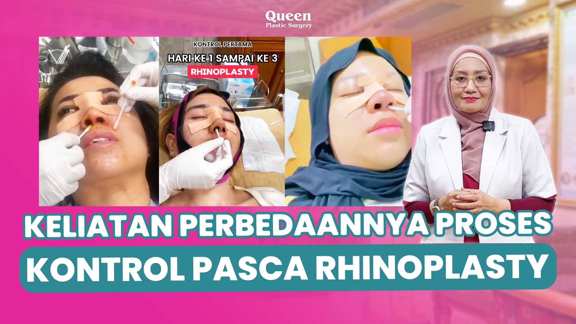Kapan Hidung Kembali Normal Pasca Rhinoplasty? Yuk, Cari Tahu Prosesnya!