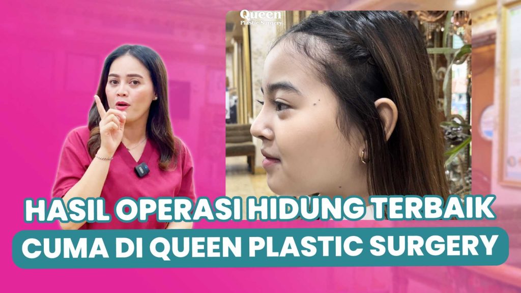 Kapan Hidung Kembali Normal Pasca Rhinoplasty? Yuk, Cari Tahu Prosesnya!