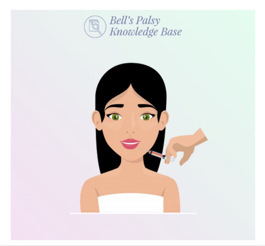 Bukan Sekadar Estetika, Inilah Peran Penting Botox dalam Menangani Bell’s Palsy