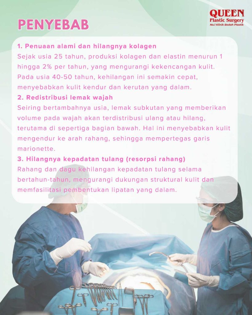 Benarkah Facelift Mampu Mengangkat Sudut Mulut yang Turun (Garis Marionette)?