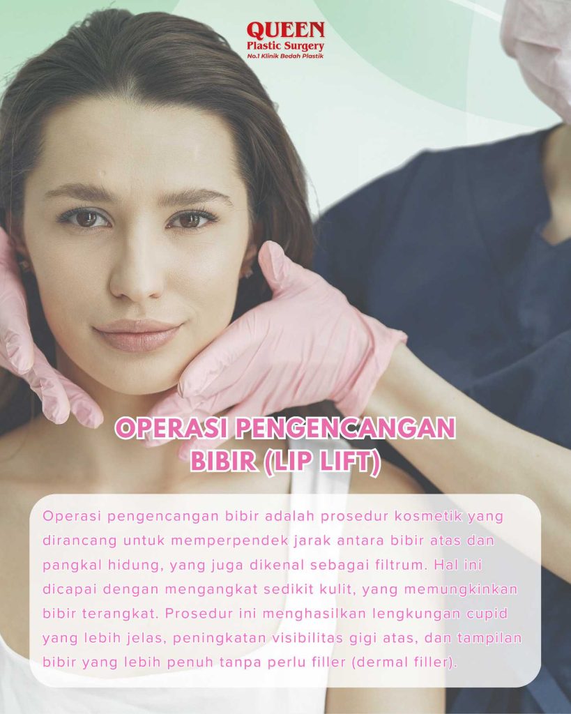 Apakah Operasi Pengencangan Bibir Dapat Mengubah Senyum? Fakta Medisnya Seputar Lip Lift