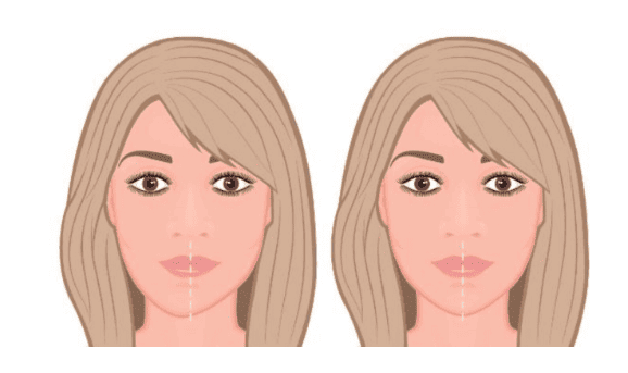 Facelift Bukan Hanya Anti-Aging: Cara Atasi Wajah Tidak Simetris!
